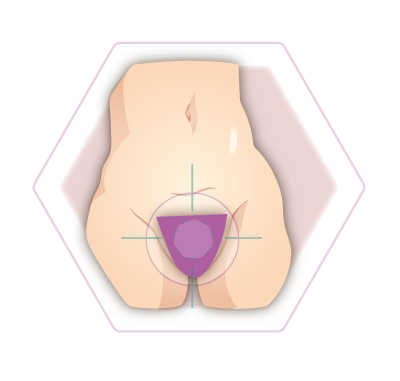 Illustration haarfreiher Intimbereich