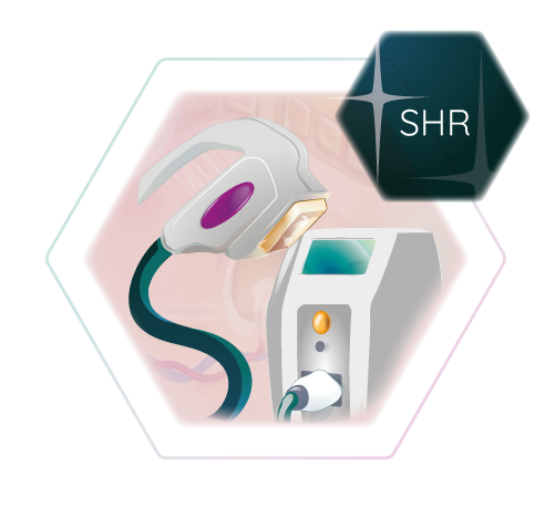 Illustration SHR Technologie